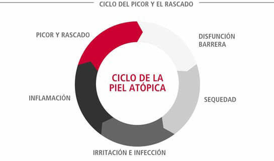 El ciclo de la piel atópica