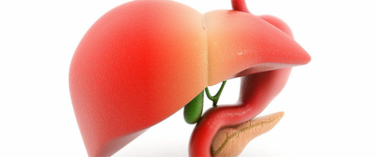 Cirrosis hepática