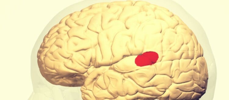 Como se diagnostica la afasia de Wernicke