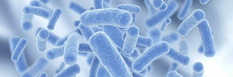 Legionella