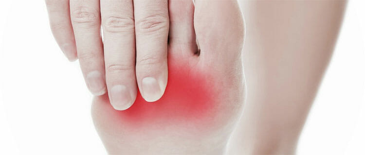 Neuroma de Morton
