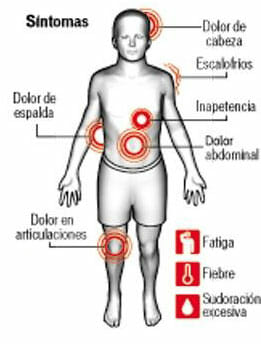Síntomas de la brucelosis