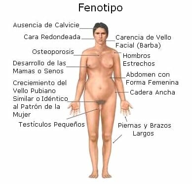 Características síndrome de Klinefelter