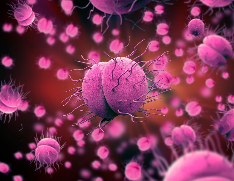 Gonorrea: causas, síntomas y tratamiento