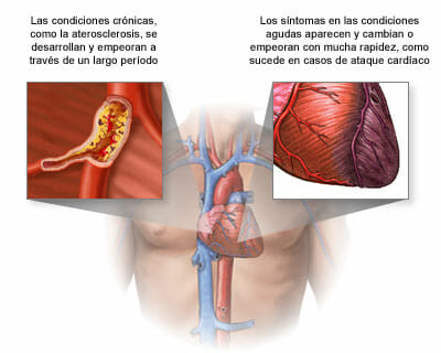 Causas del cor pulmonale