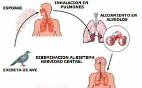 Causas de la psitacosis