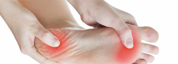 Fascitis plantar: causas, síntomas, diagnóstico y tratamiento