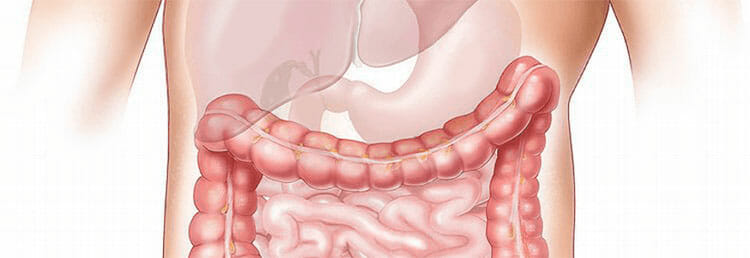 Úlcera duodenal: causas, síntomas, diagnóstico y tratamiento