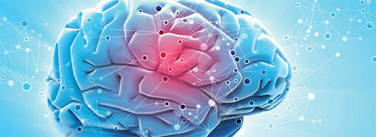 Cerebro sano