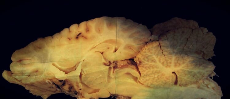 Corteza cerebral