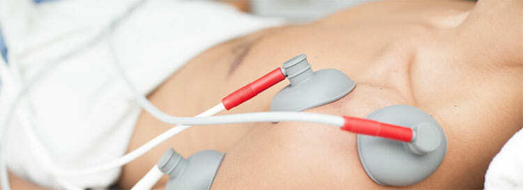 Electroterapia