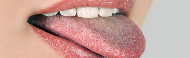Lengua blanca
