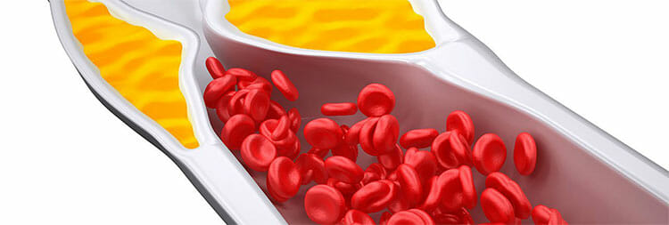 Una dieta saludable ayuda a controlar el colesterol malo (LDL)