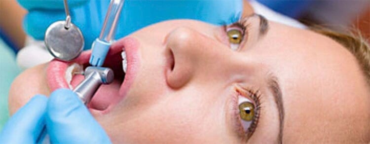 Cuánto dura una endodoncia