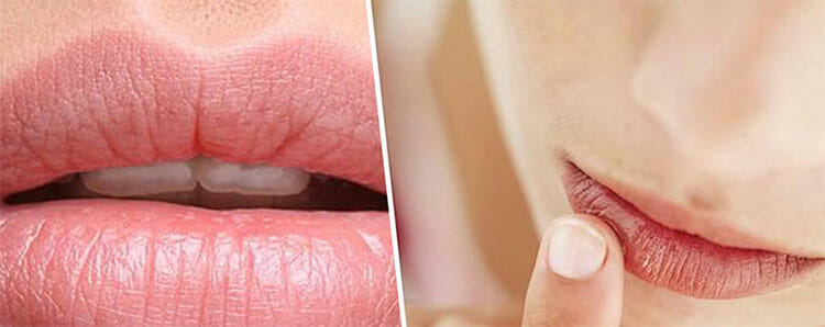 Cuidados esenciales para sanar y proteger los labios