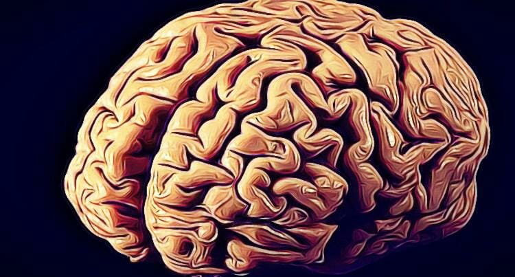 Hemiplejia