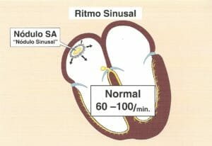 Definición del ritmo sinusal