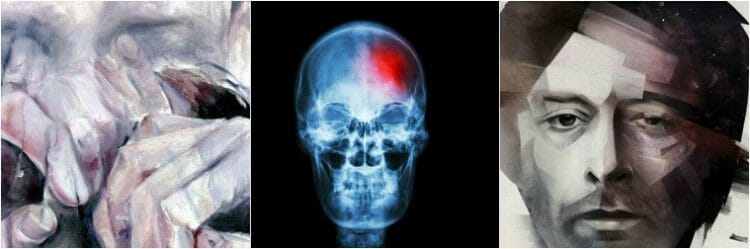Tratamiento de la anosognosia