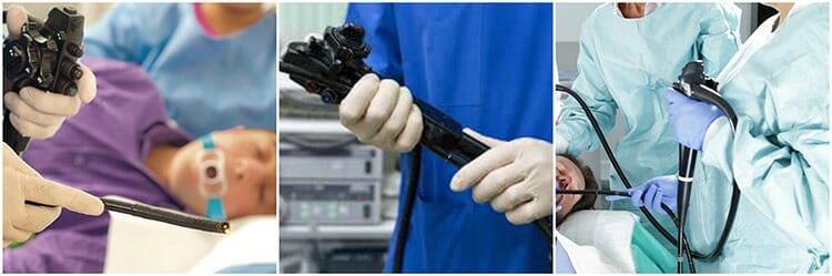Gastroscopia: qué es, preparación, procedimiento y resultados
