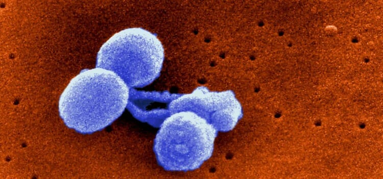 Tratamiento de la meningitis