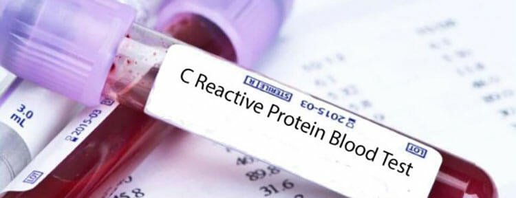 Proteína C reactiva alta