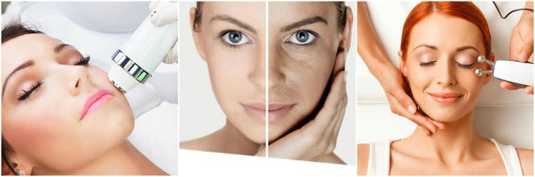 Radiofrecuencia facial
