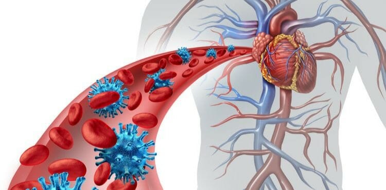Causas de la sepsis