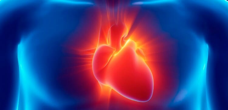 Infarto de miocardio