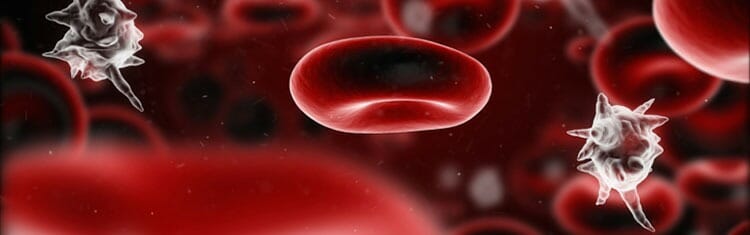Sepsis