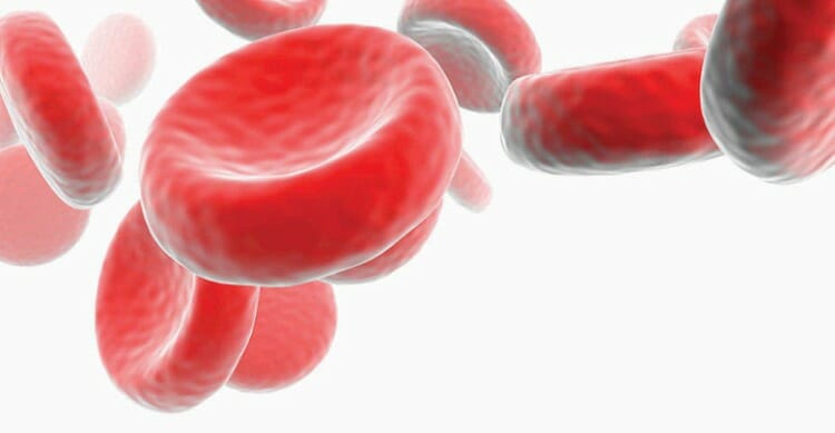Anemia