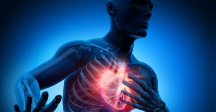 Cardiomegalia