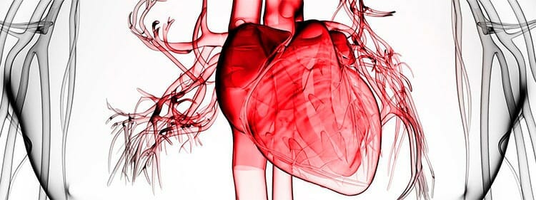 Pericarditis
