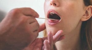 que significa tener la lengua blanca