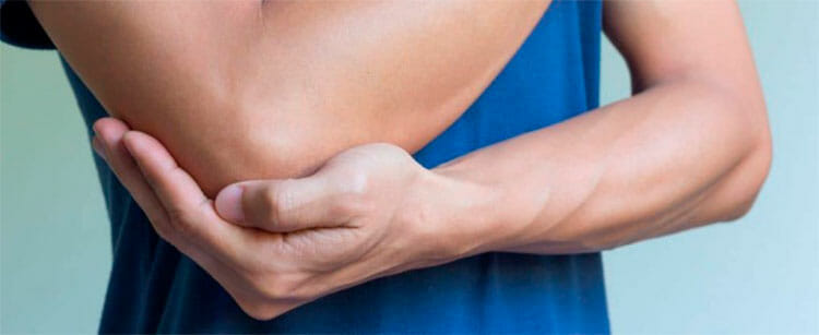 Tratamiento de la bursitis