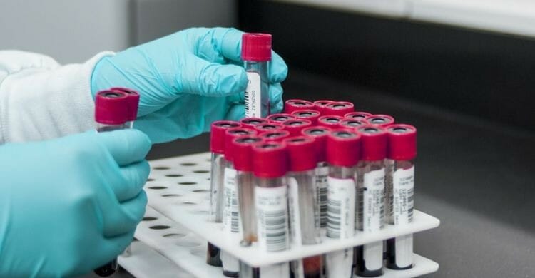 Gasometría: qué es, tipos, valores normales y procedimiento