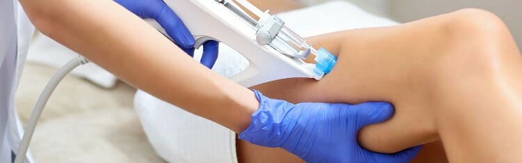 Mesoterapia