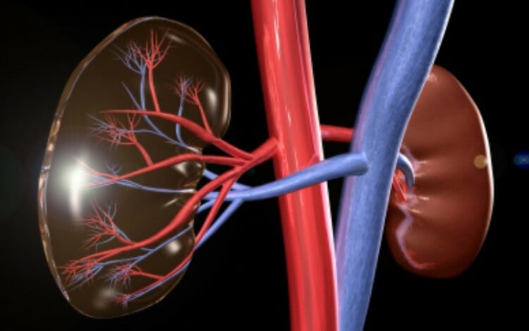 Preparación de la urografía