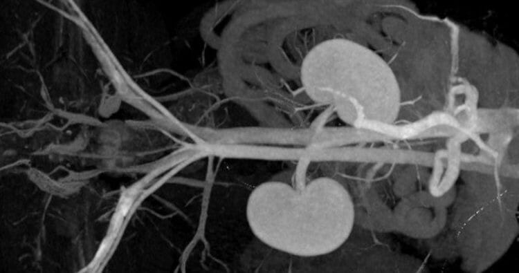 Urografía: qué es, para qué sirve y cómo se realiza