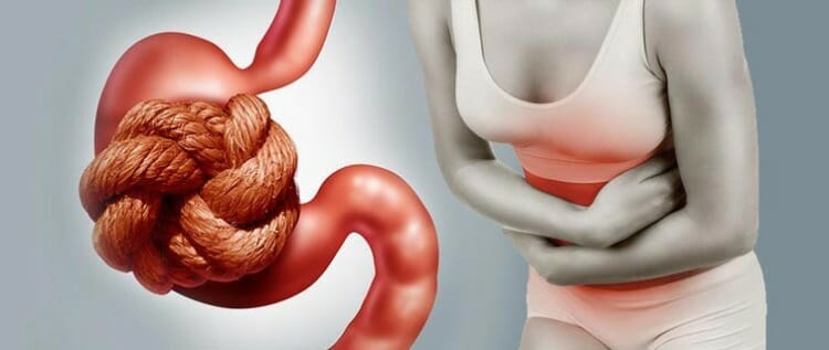 Alimentos que más estriñen Alimentos que más estriñen