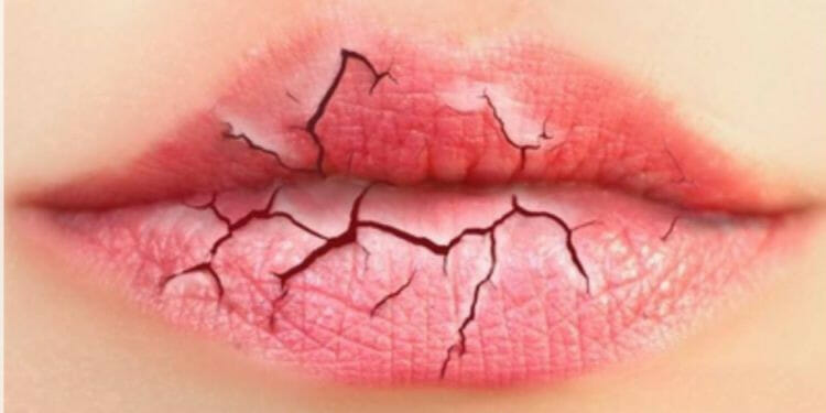 Causas de los labios agrietados
