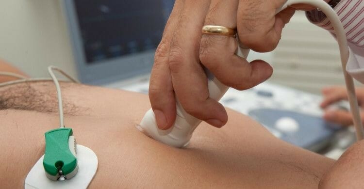 Ecocardiograma