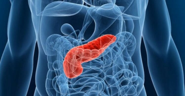 Cáncer de páncreas