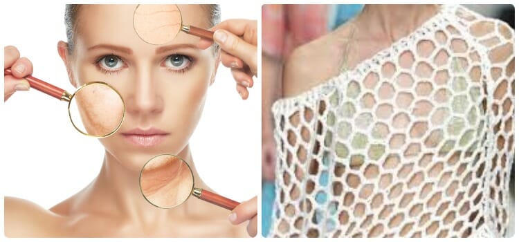 Dermatopatofobia y tripofobia