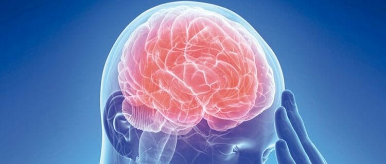 El ictus también afecta a los jóvenes