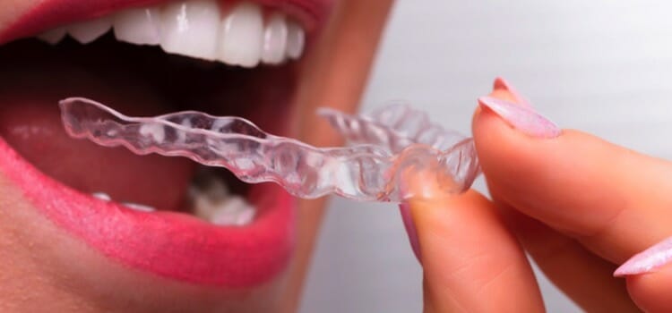 Mantenimiento de la férula dental