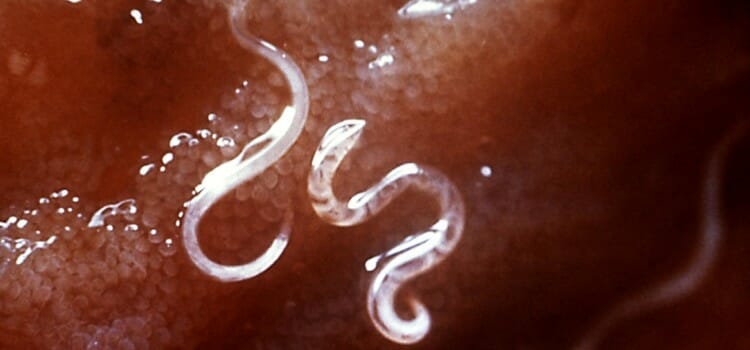 Parásitos en el intestino