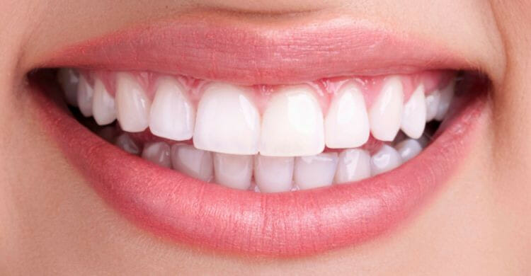 Cómo blanquear los dientes en casa