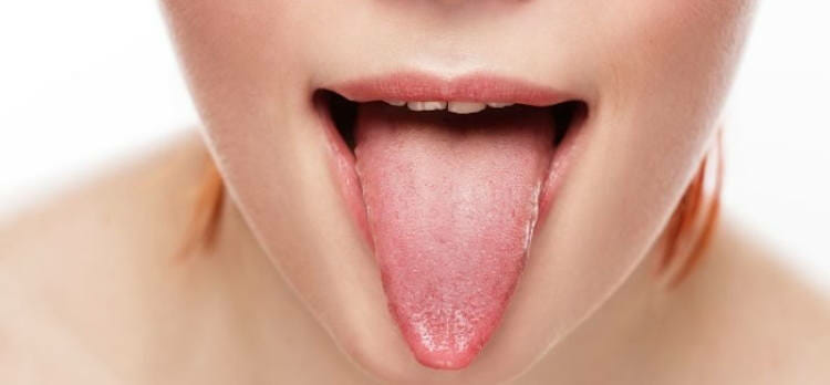 Granos en la lengua