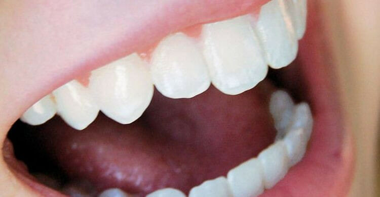 Los mejores remedios caseros para blanquear los dientes en casa