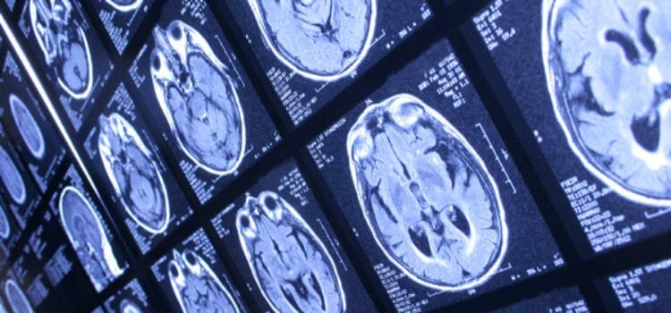Tipos de neurociencia